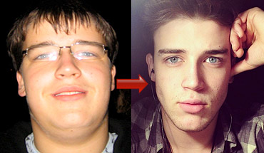 Fat Loss In Face 22