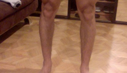 Skinny legs big online calves