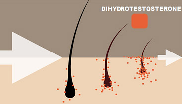 Will 5 Grams of Creatine Cause Hair Loss A Closer Look